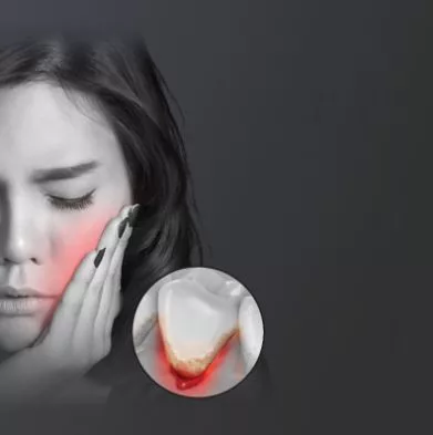 Ultrazvukový zubný čistič