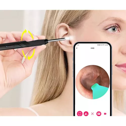 Bezdrôtové ucho čistiace zariadenie s endoskopickou kamerou.